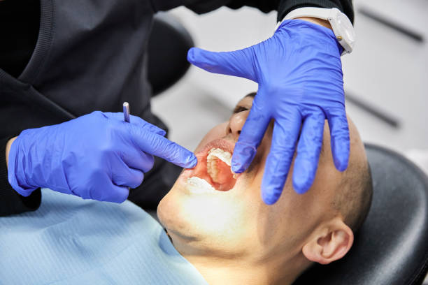 Best Emergency Tooth Extraction in Strasburg, OH